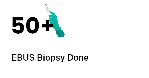 50 EBUS biopsy